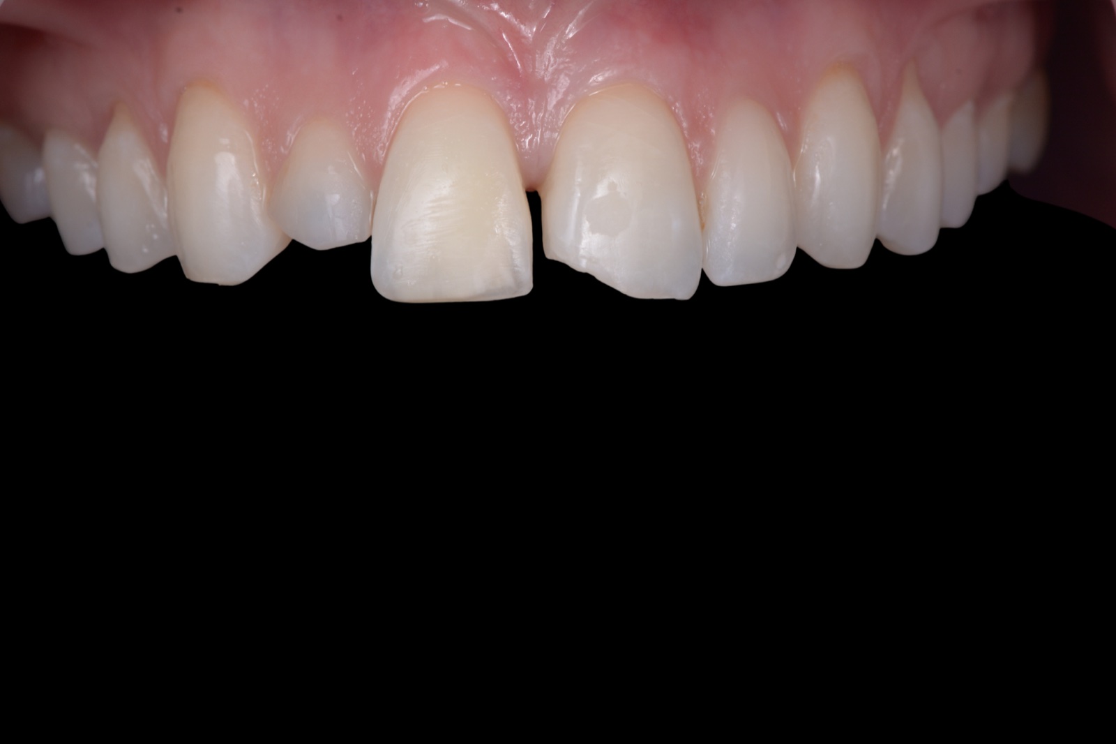 Smile and Cosmetic Concerns