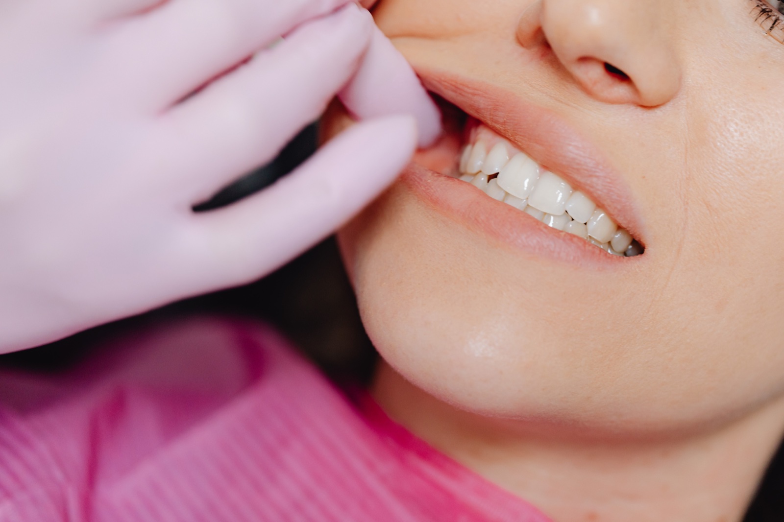 Teeth Grinding (Bruxism)