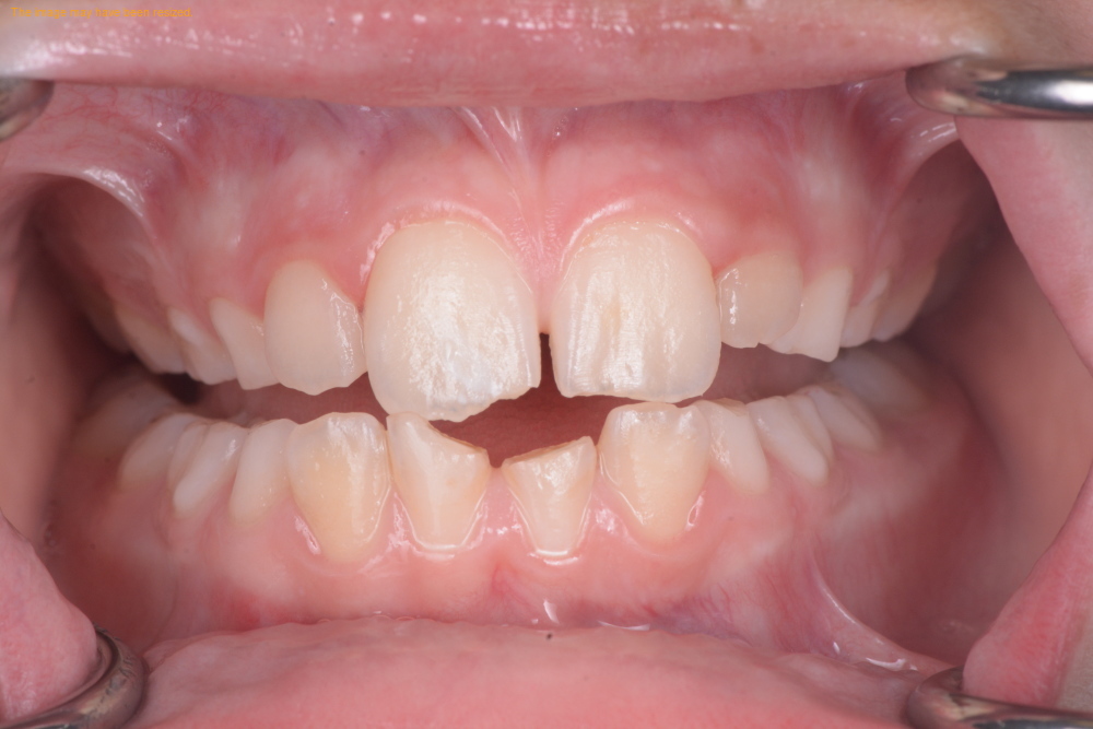 Smile Makeovers case 19, before