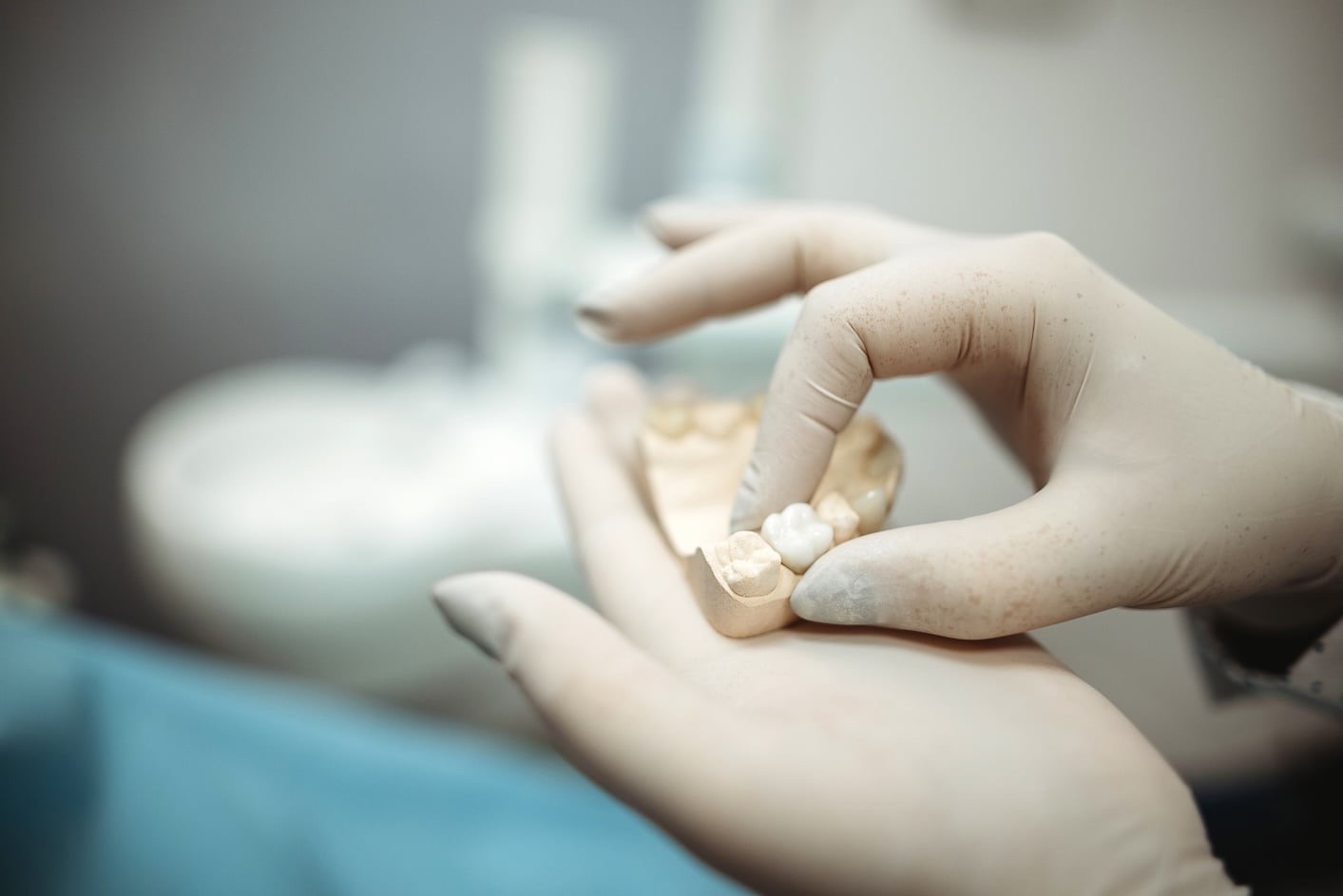 Dentures vs. Implants: How to Choose What’s Right for You