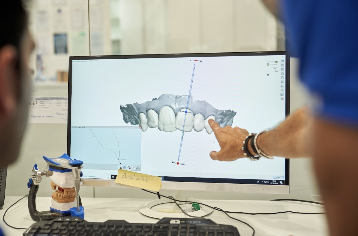 How To Prepare For Your First Visit To A Prosthodontist?