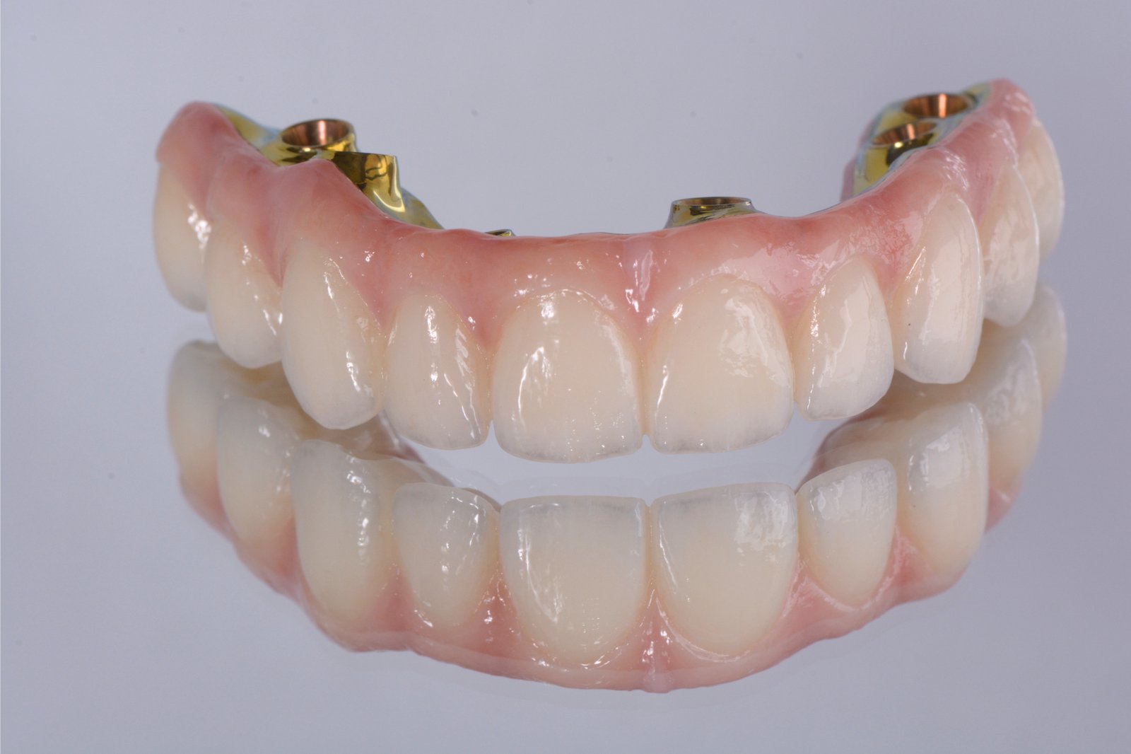 All-on-X Dental Implants