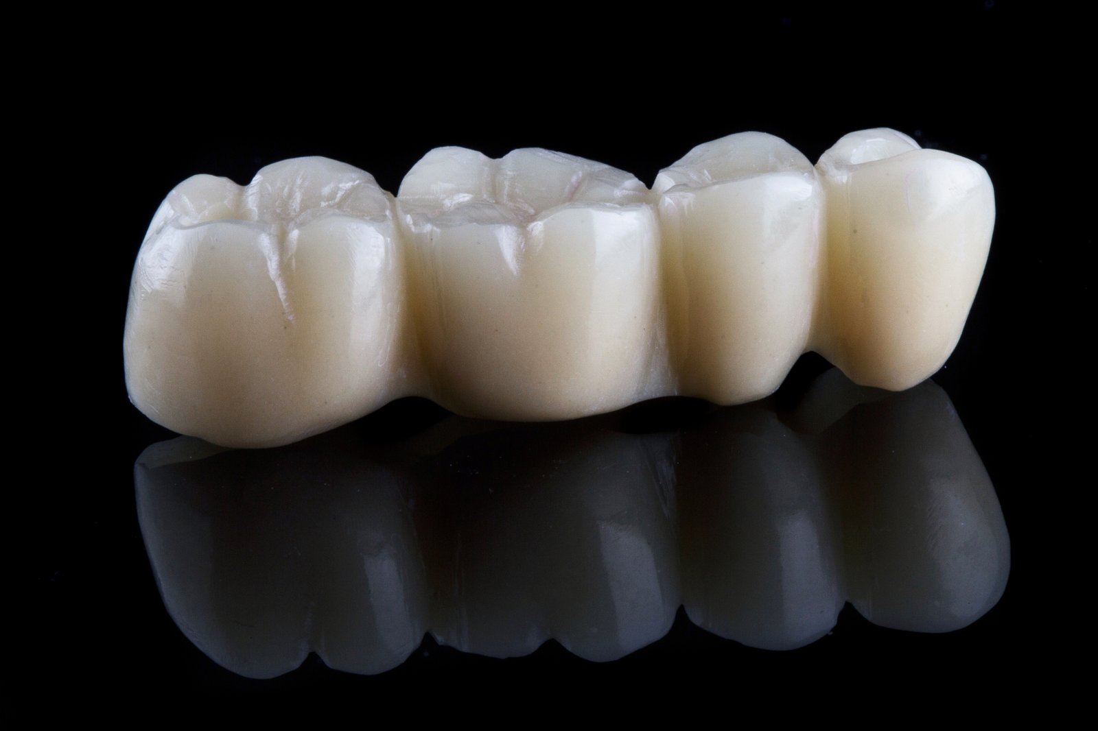 Dental Bridges