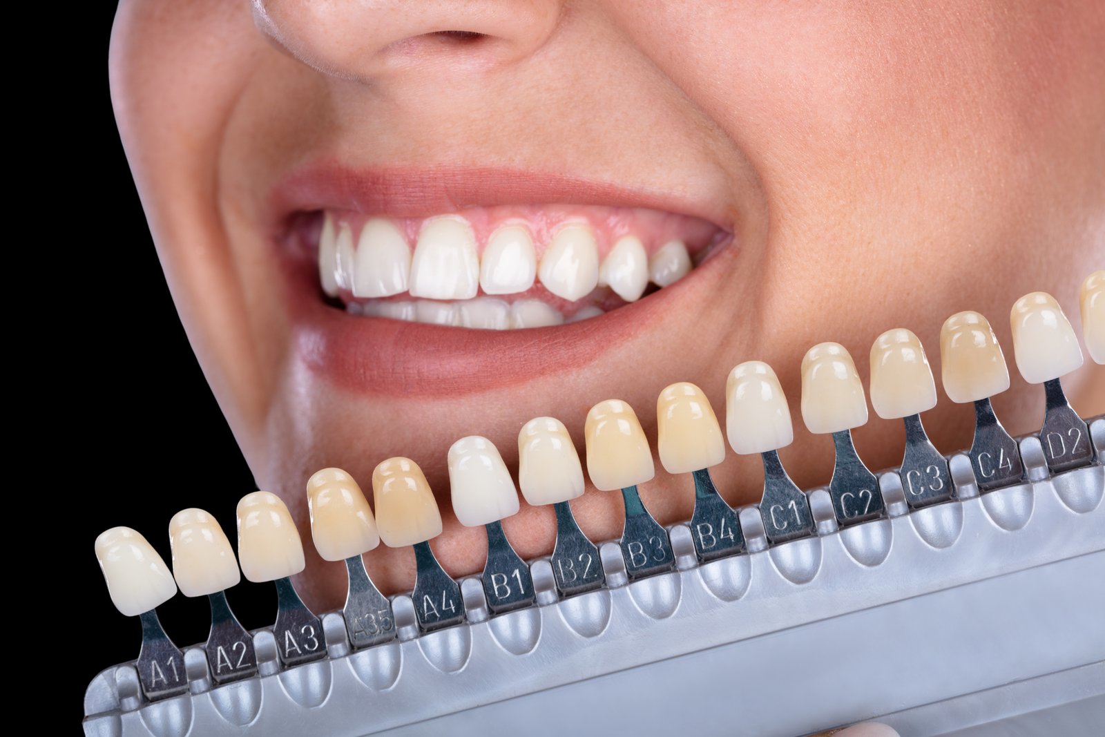 Composite Restorations