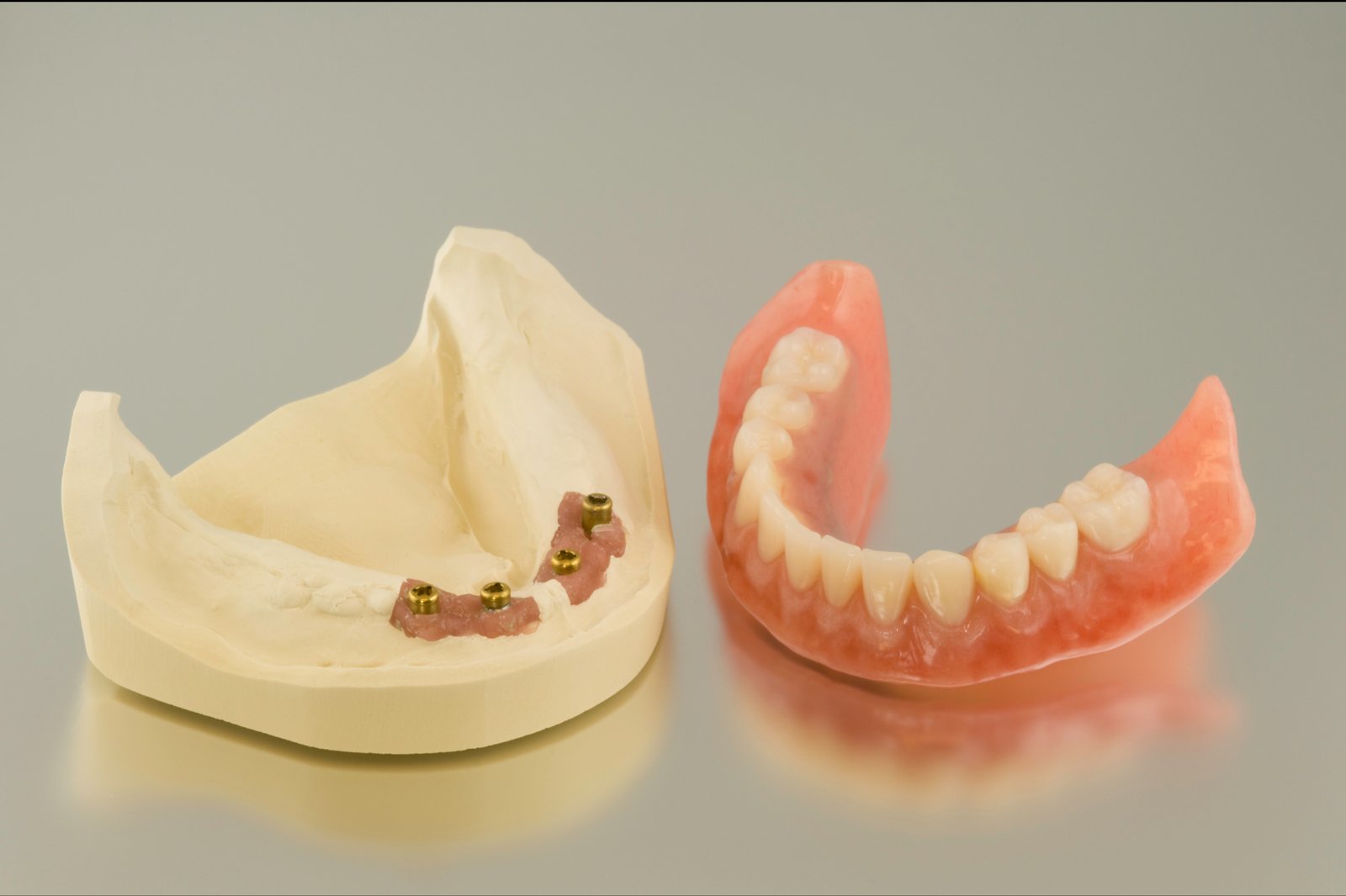Full Mouth services