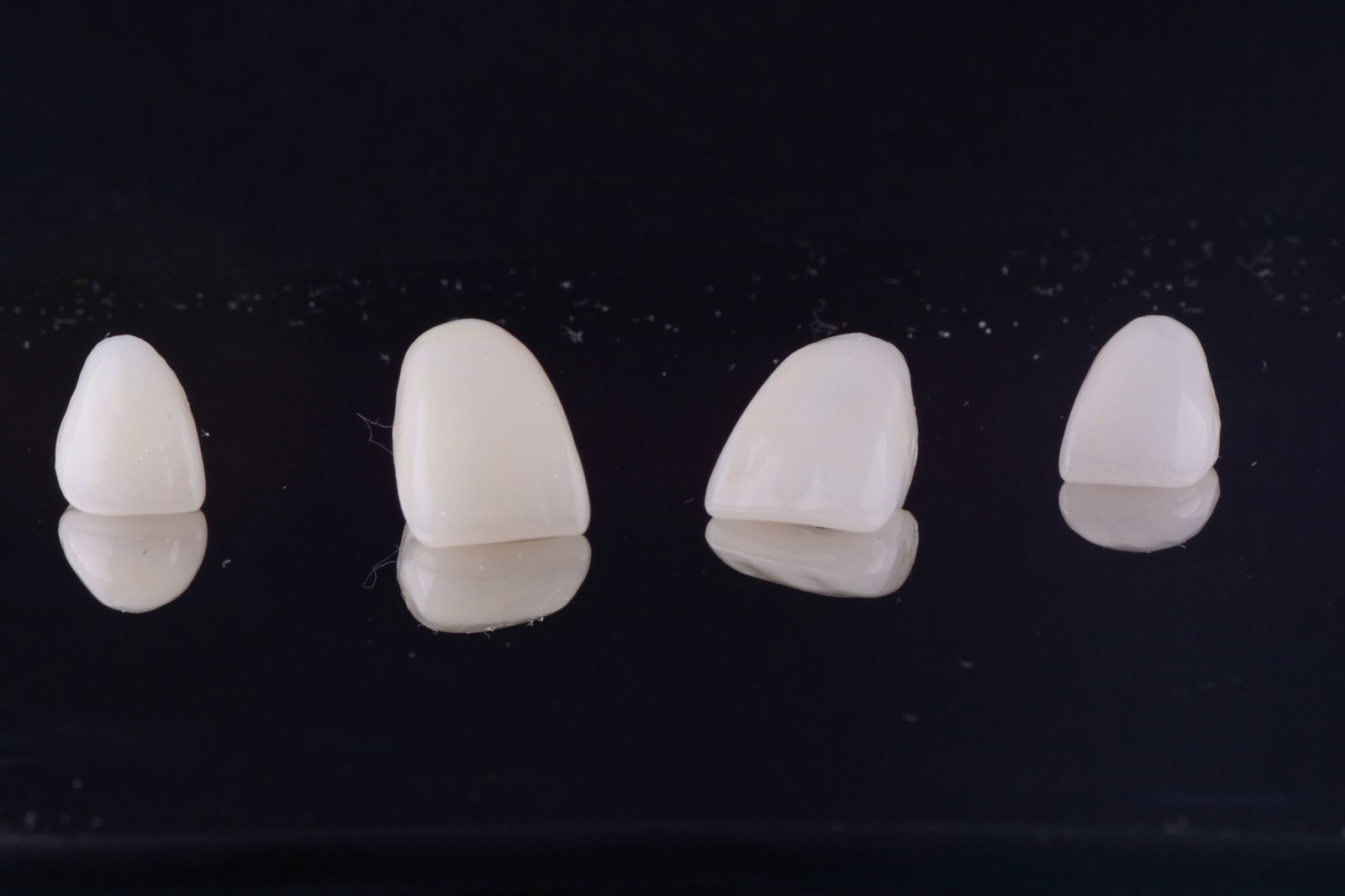 Porcelain Veneers