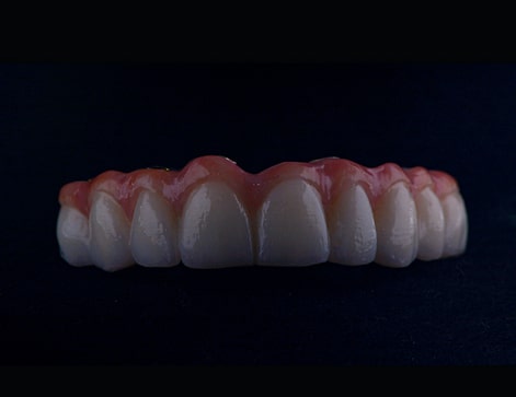 Front-teeth-model